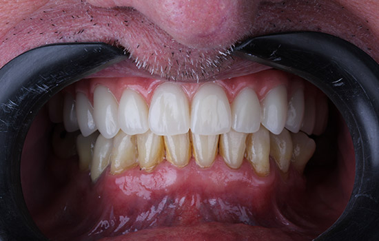 Casos-Wilson-02.jpg